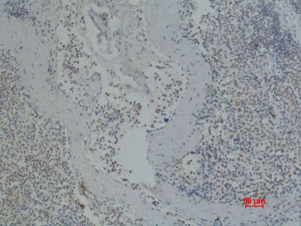 CD41 Monoclonal Antibody(Q90)[
