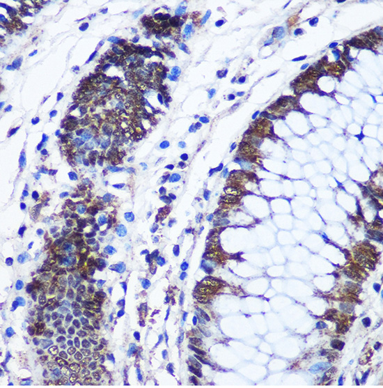 CTCF antibody[38199]