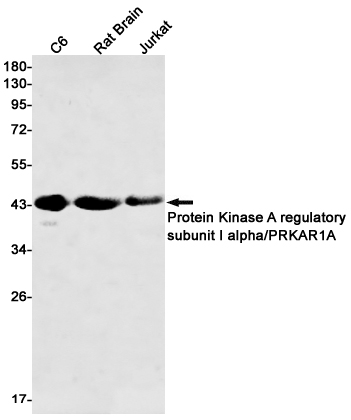 PKA RI alpha Rabbit mAb[52529]