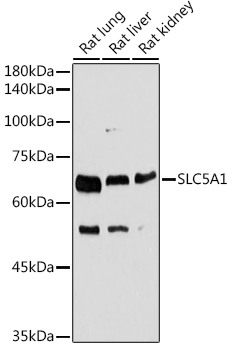 SLC5A1 antibody[38596]