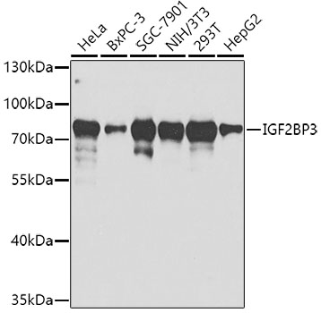 IGF2BP3 Rabbit Polyclonal Anti