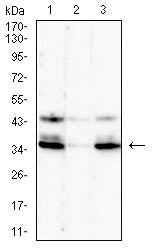 C5AR2 Mouse mAb[63180]
