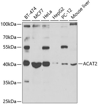 ACAT2 Rabbit Polyclonal Antibo