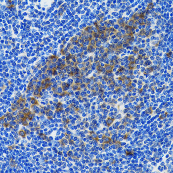 HSPH1 antibody[39052]