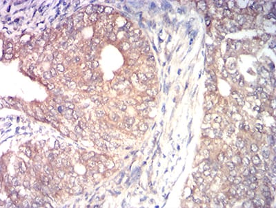 MAP3K14 Mouse mAb[63903]