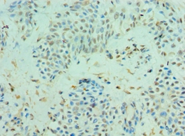 CLIC4 Polyclonal Antibody[4212