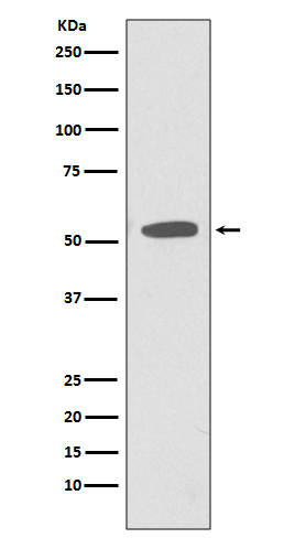 CD47 Rabbit mAb[56041]