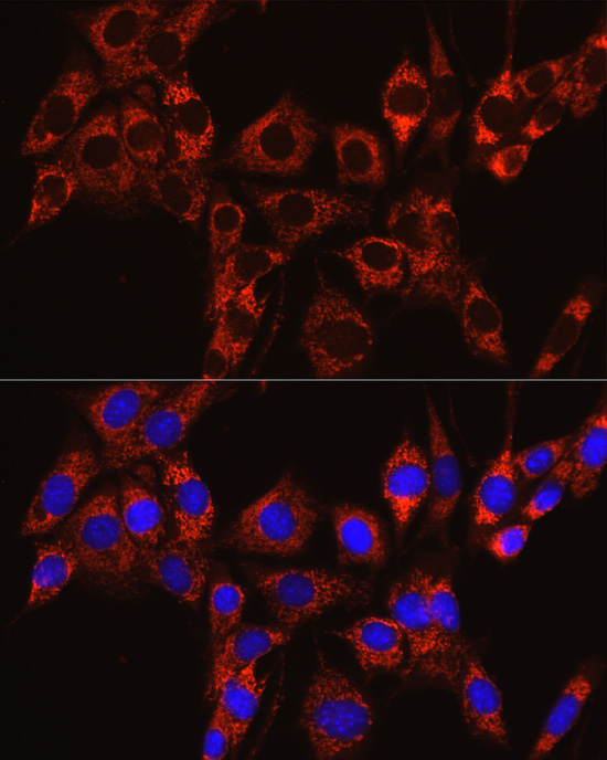 IRAK4 antibody[38750]