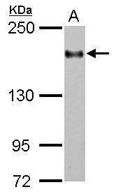 CD11a Antibody[35374]