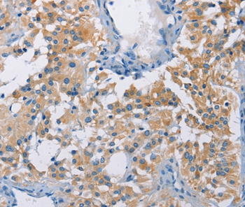 ATP6AP2 Antibody[36270]