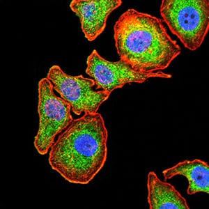 SERPINA1 Mouse mAb[64221]