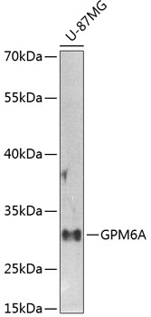 GPM6A Rabbit Polyclonal Antibo