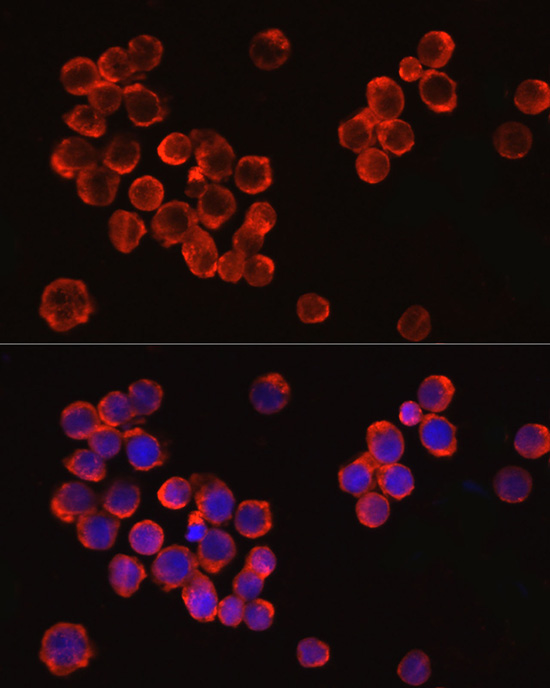 IRAK4 antibody[38750]