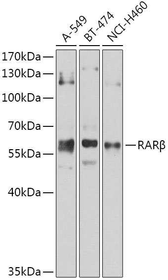 RARB Rabbit Polyclonal Antibod
