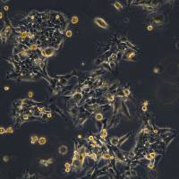 浙江（杭州）美森 人咽头癌胸水转移细胞Detroit562（Luc1）现货