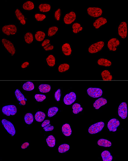 KHDRBS1 Rabbit Polyclonal Anti
