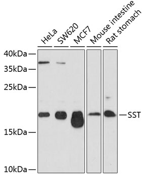 SST Rabbit Polyclonal Antibody