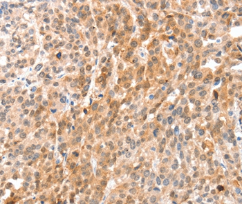 ANXA8 Antibody[35621]