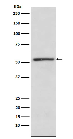 TBLR1 Rabbit mAb[56468]