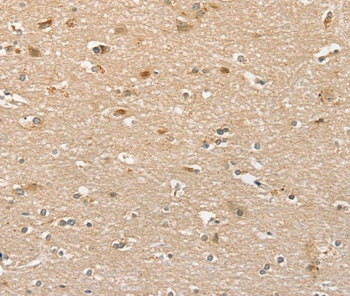 PHLPP1 Antibody[36693]