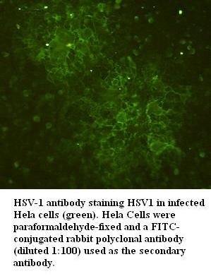 HSV-1 Antibody[39395]
