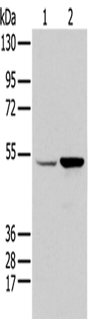 EGR2 Antibody[43313]