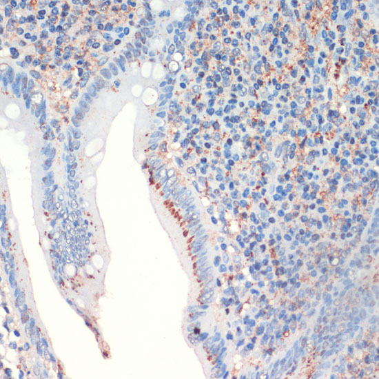 SST Rabbit Polyclonal Antibody