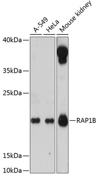 RAP1B Rabbit Polyclonal Antibo