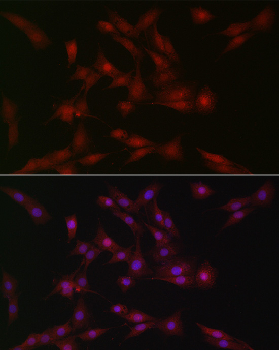 SOCS1 Rabbit Polyclonal Antibo