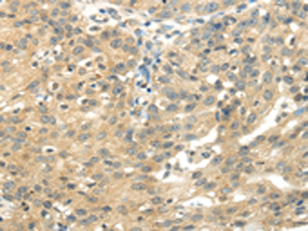 UBAP2L Antibody[42800]