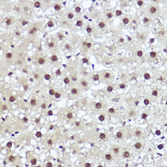 WBP11 Rabbit Polyclonal Antibo