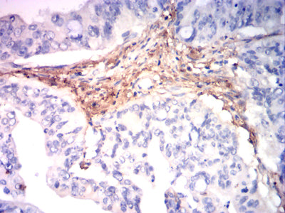 ITGA1 Mouse mAb[63794]