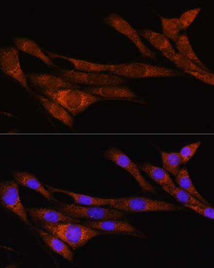 ARHGAP30 Rabbit Polyclonal Ant