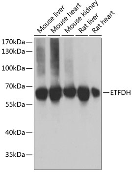 ETFDH antibody[39025]