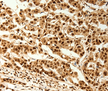 C12orf5 Antibody[37280]