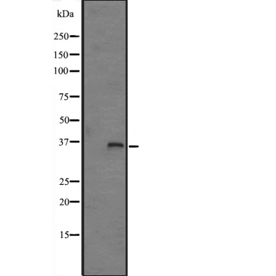 FN3K Antibody[44782]