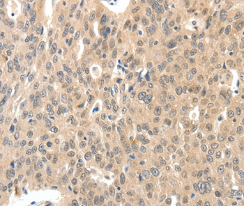 ROS1 Antibody[37230]