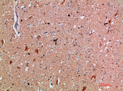 CD300e Polyclonal Antibody[468