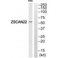 ZSCAN22 Antibody[35151]