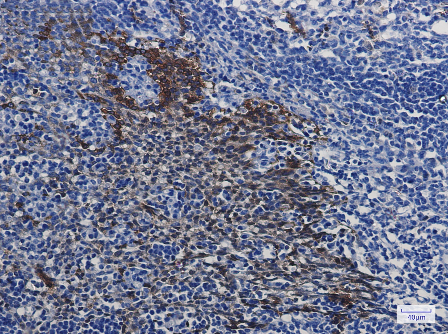 Hsp70 1A Rabbit mAb[52350]