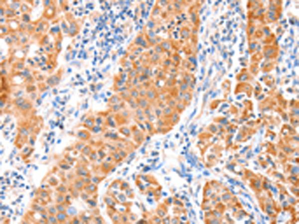VANGL1 Antibody[35999]