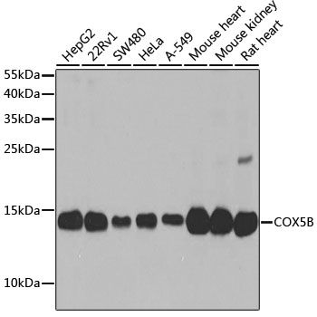 COX5B Rabbit Polyclonal Antibo