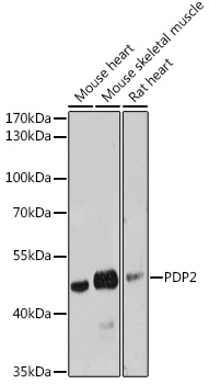 PDP2 Rabbit Polyclonal Antibod