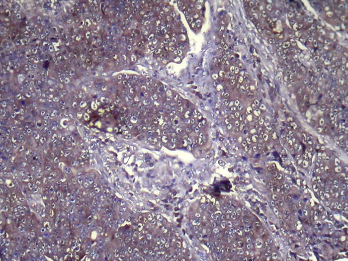 GLIPR1L1 Antibody[42994]