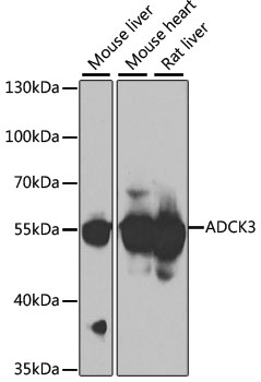 ADCK3 Rabbit Polyclonal Antibo