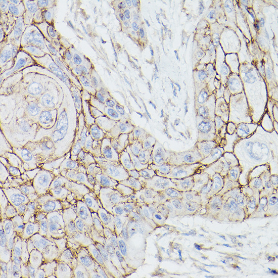 THBD Rabbit Polyclonal Antibod