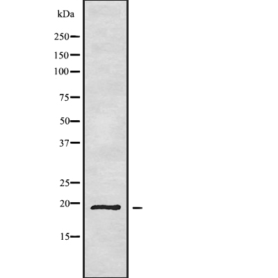 CD164L2 Antibody[44455]