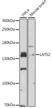 LATS2 Rabbit Polyclonal Antibo
