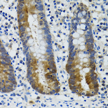 HSPH1 antibody[39052]
