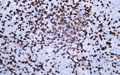 CD8 a mouse mAb(ABT155)[58251]